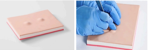 Sebaceous Cyst Removal Training Module